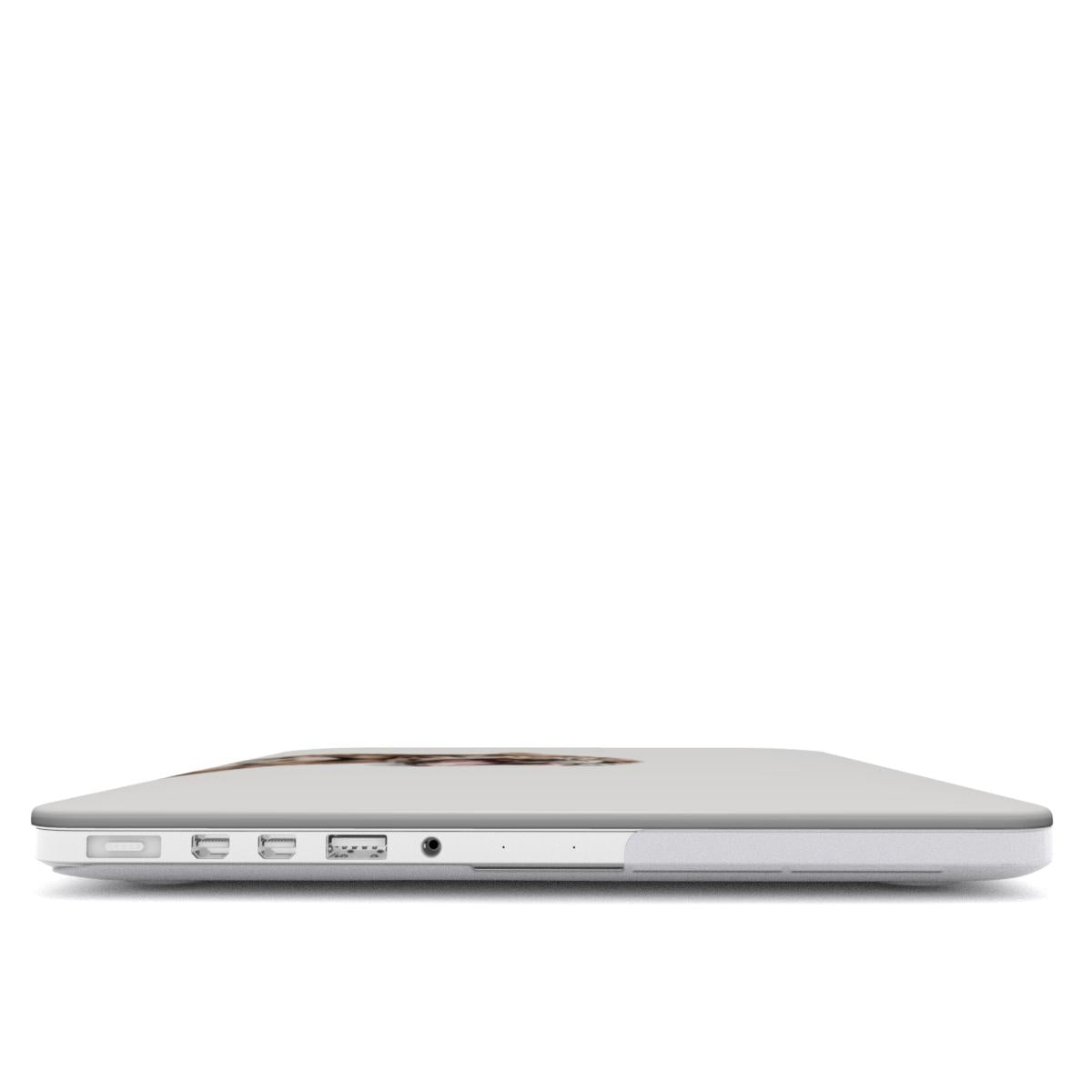 Fauva Macbook Case