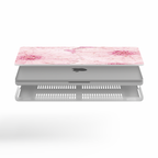 Bloomosaic Macbook Case