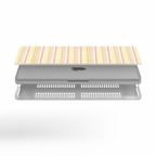 Como Macbook Case