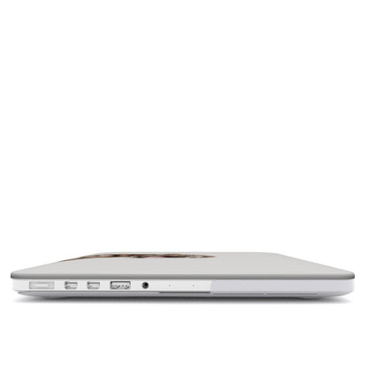 Fauva Macbook Case