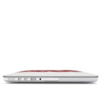 Strawberry Macbook Case