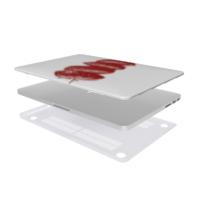 Strawberry Macbook Case