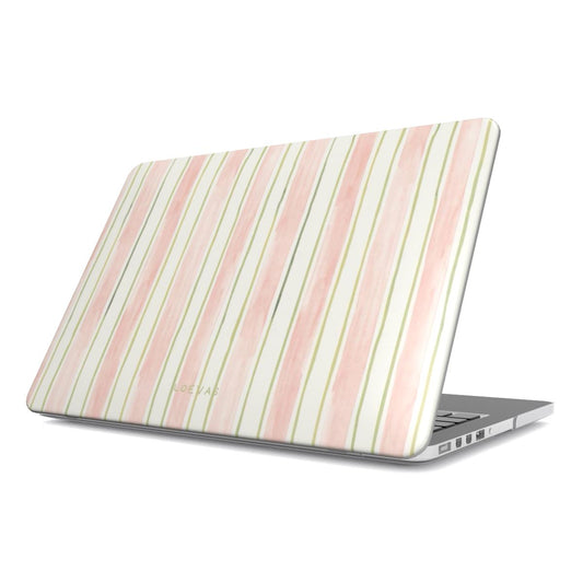 Pastel Layers Macbook Case